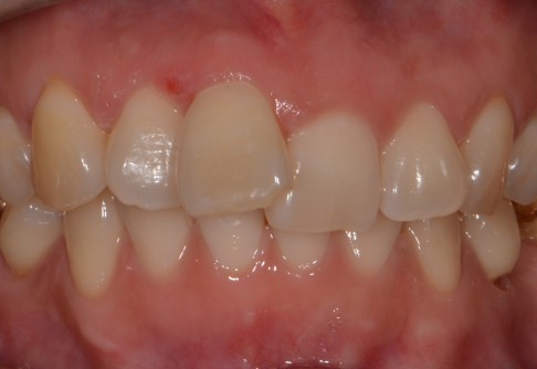 Before