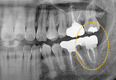 After